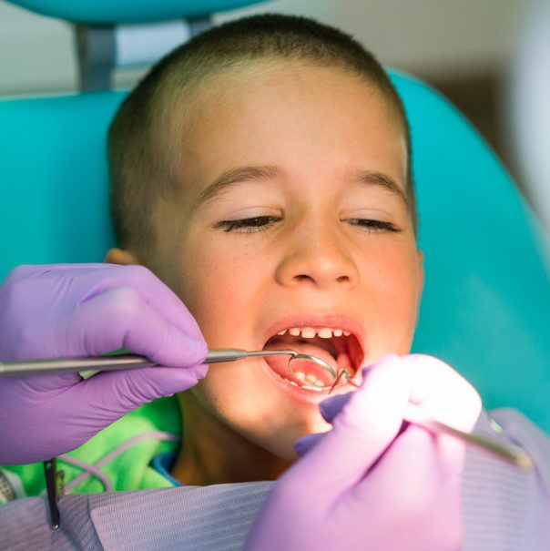 Dental Cleaning and Checkups for Children - Smile Center for Kids El Paso TX